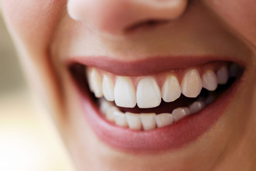 Teeth Whitening in Round Rock, TX