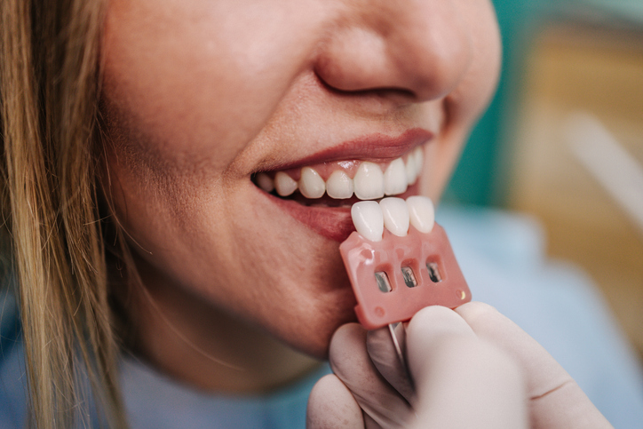 Dental Crowns vs. Veneers: Which Cosmetic Solution Is Right for You?